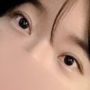 나은메디칼빌딩 | 성형외과 쌍꺼풀 수술 상담 후기 (에이트, 히트, 옐로우)