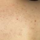 워시엔카 | 등드름바디워시 바디클렌져 엔카 바하여드름바디워시 사용후기