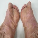 못된손톱/부천각질관리 부천패디플래닝 받으러 다녀온 찐 후기