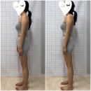 매월2로15번길R | 부산 서면 비대칭관리 자이로토닉 : 로온 얼굴안면비대칭 &amp; 자이로토닉