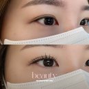 태영프라자약국 | 의정부 속눈썹연장 자연스러운 C컬 고운눈