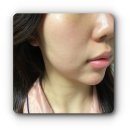 청주 율량동 피부관리 / 청주 웨딩케어 / 청주 여드름케어 추천 많은곳에서 원데이필 받았어요!
