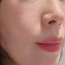 동아당약국 | 동아제약 멜라논크림 내돈내산 후기