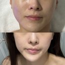 바디핏 | [에스테틱] 위례 피부관리 받고 피부결이 달라졌어요｜새결바디핏 후기