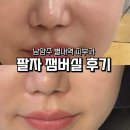 별내역 | 남양주 별내역 피부과 잼버실 리프팅 팔자 내돈내산 후기