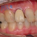 의정부본플란트치과의원 이미지