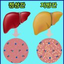 구기자식초 만들기, 지방간, 간암 예방에 좋은 음식 이미지