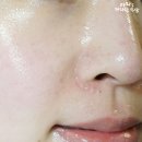 베리홉 부작용 극복 비포애프터 공유