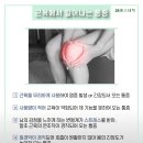 JS케어 이미지