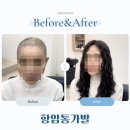 항암통가발 통풍 잘 되는 초경량 인모가발 후기 모음
