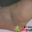경희피치한의원 이미지