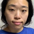 홈케어 추천 / 수더포르테 앰플, 피부회복 방법 : 에센시엘 포텐셀 뷰티디바이스 니들
