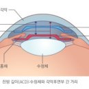 렌즈공간 이미지