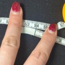 바로보고한의원 | [수원 지방분해주사] 수원 인계동 고든한의원 지방분해주사 후기!