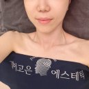 고은햇살 | [Beauty]경락 작은얼굴 관리, 결이고은 선릉점 — 루프탑 정원에서 힐링하며 진짜 작아진 얼굴 라인