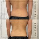 빛나리자 이미지