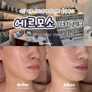 마산회원구 ⓕ-13 | 마산피부관리 에르모소 프리미엄 1:1 맞춤 모공관리 솔직후기