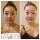 [공지] 이매동피부관리? 친구보다10년은 더 늙고 싶지 않은 분들만 클릭!