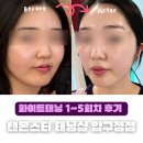엔젤뷰티 | [압구정태닝] 탠몬스터 압구정점 : 탄 피부 얼굴 집중 화이트태닝 5회 후기 뷰티엔젤 ELT3