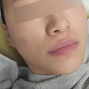 익산피부샵 솜이뷰티 21: 예민·건조 피부 MTS 후기