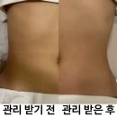 [솔직후기] 서현웨딩관리 맛집✨ 에스와이뷰티크에서 1회만으로 변화주기!