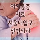 서울대입구 정형외과 어깨통증 치료 이미지