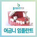 군포본플란트치과의원 이미지