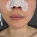 인성 에스테틱 | 울산 작은얼굴만들기 두상관리 잘하는곳 최지우에스테틱