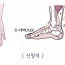 월오사암침, 매독. 임질 치료 이미지