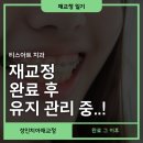 성인 치아재교정 완료 후 관리..!(feat.유지장치도 다르다)