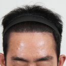 부산 맘모스헤어라인의원 이미지