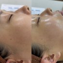 동삭동 소로 3-394 | 진해 예쁨온스킨 6주 맑아지기 프로그램 맑은 1주차 화이트업 필링