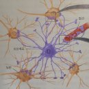 ＜치매＞ 원인은 별아교세포(星狀교세포)의 광란으로 밝혀졌다. 이미지