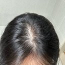 기능성화장품 ‘닥터방기원 랩 헤어토닉’ 내돈내산 사용 후기 (디렉터파이 추천템, 달리프 헤어토닉...