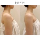 용산-407 | [위뷰티 용산점] 예비신부 관리로 소문난 용산에스테틱 승모근마사지 후기