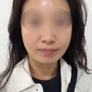 모노리스 솔라 | [안산/중앙역] 쏠라잇스킨케어 중앙동 피부관리 여드름관리 후기