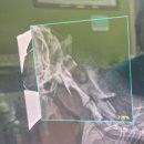 태산주상복합(태신) | 나르..목디스크 판정 + 깁스