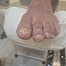 잠실역 3번출구(잠실자전거수리센터앞) | 레푸스 잠실역점 - 잠실 발톱무좀