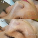 쏘티스네일 | 여수 마사지샵 건강미스킨앤바디 아쿠아필 오메가PDT 관리 받고 온 후기