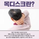 올쏘정형외과의원 네이버블로그
