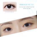 렌즈미충장로점 이미지