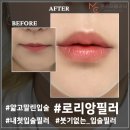 압구정 피부과 😍 마크뷰 피부진단기기 이용해 전문적으로 피부고민심층 진단해 보세요. 💯