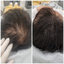 두피를디자인하는여자 네이버블로그