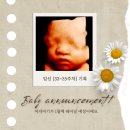 임신 [33~35주차] 기록