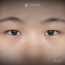 케이스성형외과의원 네이버블로그