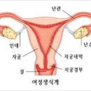 여성불임 원인 1위, 자궁내막증은 무엇? 이미지