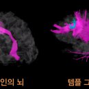 퍼펙트휴먼 Daum카페