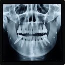 초지메이저치과의원 | 내 치아 상태, 이거 완전 실화냐?