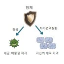 전신 홍반성 낭창 (루푸스) 이미지