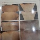 연주피부 | [당진 예비신부관리] 엘루엔에스테틱 당진점 비대칭 윤곽관리 및 피부관리 후기